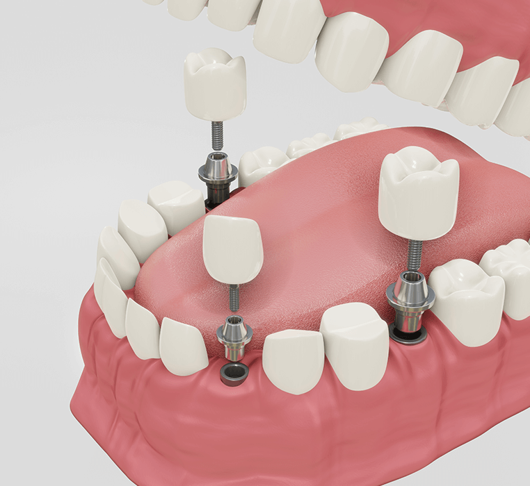 Zahnbehandlungen