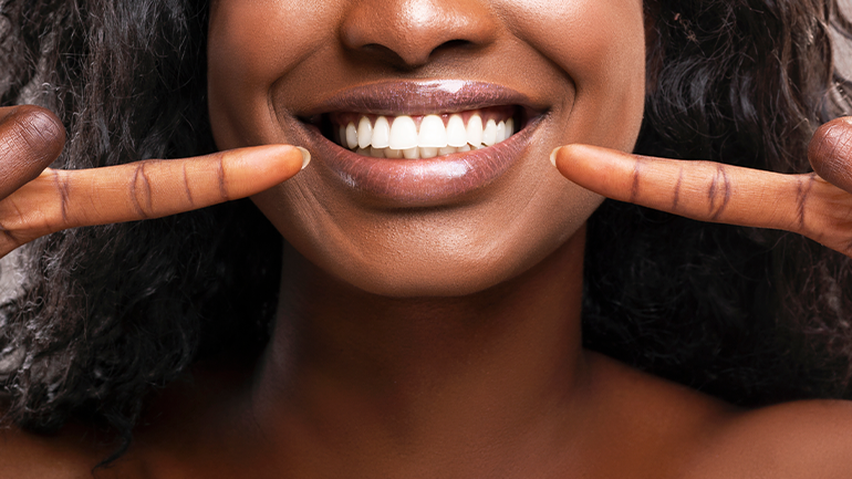 How Long Does Tooth Whitening Last?
